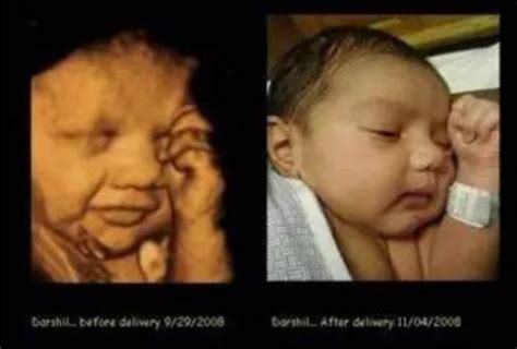 四维照片跟真婴儿对比（宝宝的四维彩超照片和实际相貌有区别吗）-幼儿百科-魔术铺