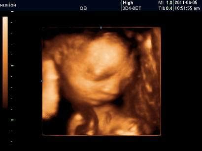 怀孕26周!胎儿有多重了?_百度宝宝知道-怀孕36周的胎儿一般有多重？