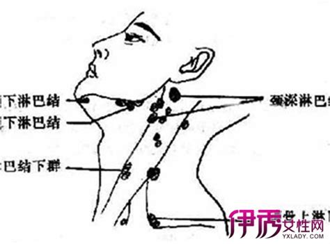 面部淋巴结分布图图片 面部淋巴结分布图图片