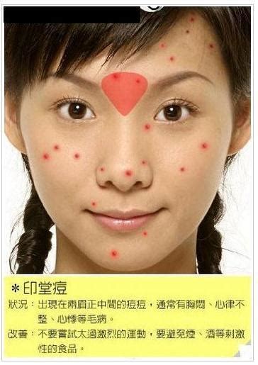 本人脸上长痘，去看了武汉第一医院皮肤科，说一下感想以及情况，供大家参考 - 知乎