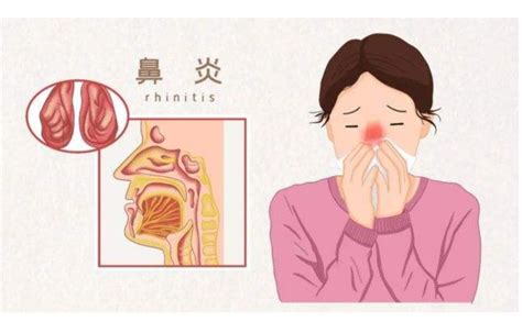 鼻子不通气是怎么回事怎样治疗（为什么会鼻塞？包括炎症、肿块、鼻腔结构变化，找准诱因才能治好） | 说明书网