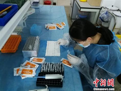 云南：头发样本毒品检测研究取得阶段性成果-中国禁毒网