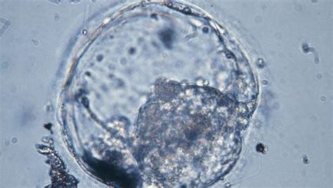 两次胚胎出现三倍体-第三代试管婴儿技术可以避免吗？ - 知乎