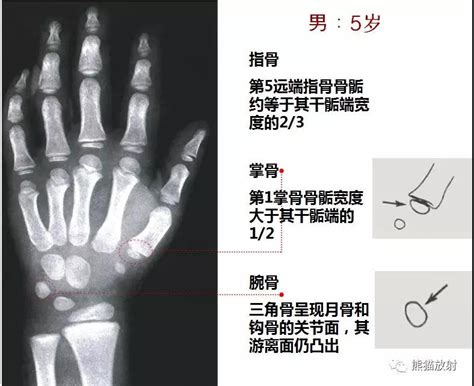 【中华05标准】读准X光骨龄片最基础知识解析 - 重庆展望未来骨龄检测科研所