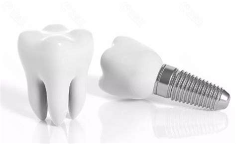 即刻种植牙的利与弊，传统种植牙和即刻用哪个好？_皓齿口腔网