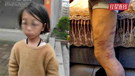 四川11岁女孩被刀割针扎满身伤 警方刑拘养父母_中国网教育|中国网