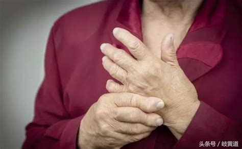 手部关节痛，或与这6种疾病有关，要及时检查，别大意了