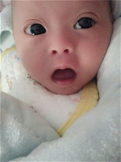 唐氏儿吐舌头图片