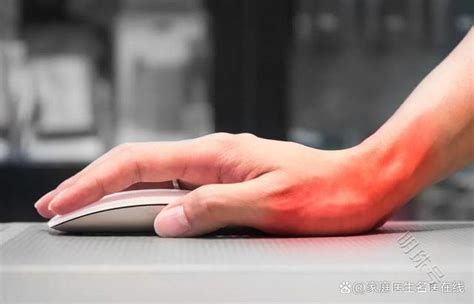 手指伸不直图片