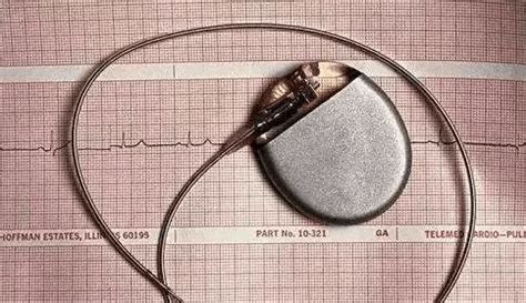 图解心脏起搏器植入