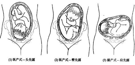 【科普】孕妇动态3D分娩图, 带您全面了解分娩过程! 产科 -山东省立医院
