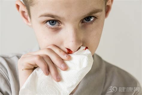 流鼻血怎样快速止住鼻血，怎样快速止住流鼻血？