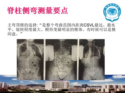 山东电力中心医院脊柱外科