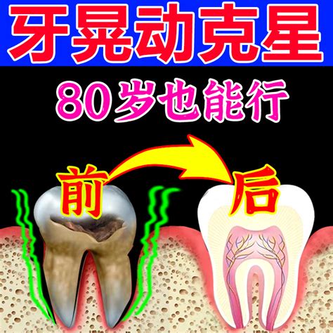 牙龈出血、牙齿变长、松动，牙周病不治疗会自行好转吗?-海南口腔医院【官网】