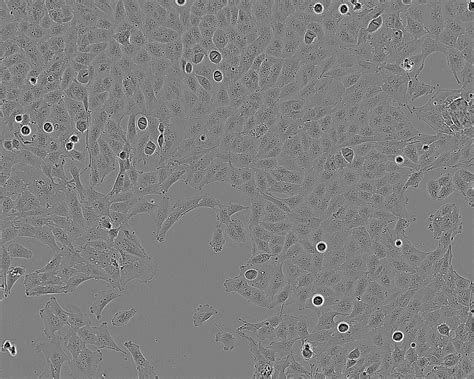 T98G细胞ATCC CRL-1690细胞 人脑多形性成胶质细胞瘤株购买价格、培养基、培养条件、细胞图片、特征等基本信息_生物风