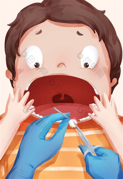 牙医给小朋友拔牙插画图片-包图网