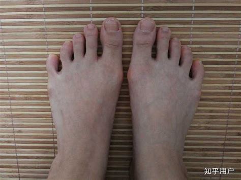 脚趾的长度，预测你一生的命势如何？ - 知乎