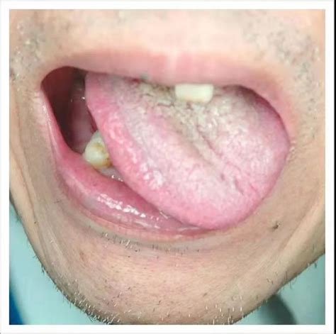 名中医教你“舌诊”，看一眼舌头就知道你哪儿病了_健康_环球网