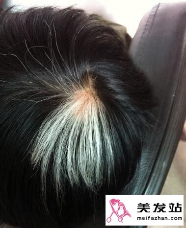 白头发长得位置示意图 白发位置揭露不同内脏问题_美发护发 - 美发站