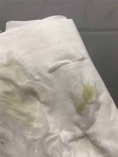 果冻状分泌物图片