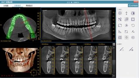 云牙-口腔管理软件,口腔门诊管理软件,门诊管理软件,牙科软件,牙医软件,牙医管理软件