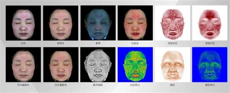 采美科普：美际3D皮肤分析仪如何利用数据构建信任， 打造医美数字化生态体系？_采美365网