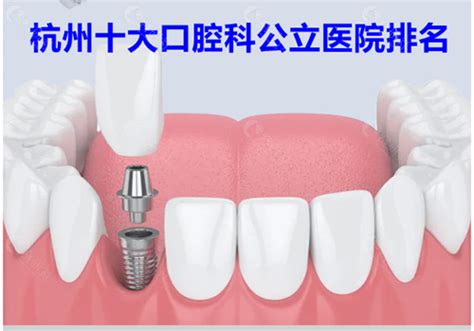 杭州人民口腔医院不是公立,但补牙正畸/种牙收费标准看便宜 - 爱美容研社