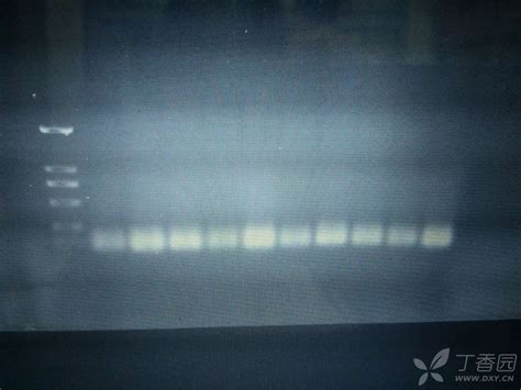 求助植物基因组DNA提取，PCR扩增后电泳无目的条带，最下面一排是杂带吗？ - PCR技术讨论版 -丁香园论坛