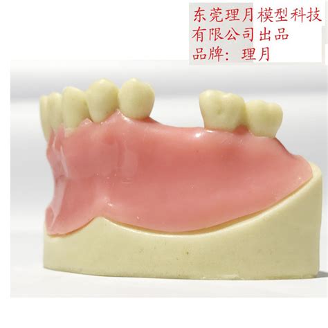 北京大学口腔医院用人工智能、3D打印与仿生材料“重塑”牙齿_中国3D打印网