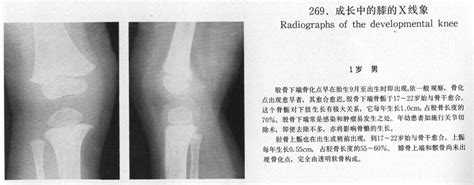 成长中的膝的X线象(骨科图谱)