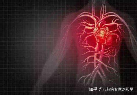 发生心脏猝死是否有什么前兆呢？5个心脏猝死前兆提醒你 - 知乎