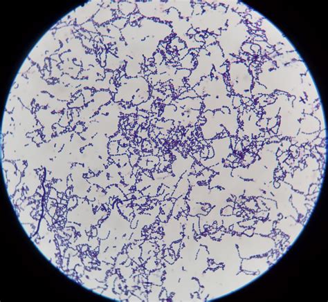 大肠杆菌(e.c oli.)细菌在显微镜下图片-商业图片-正版原创图片下载购买-VEER图片库