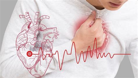 心肌缺血怎么造成的（为什么会造成心肌缺血？主要与这几个原因有关） | 说明书网