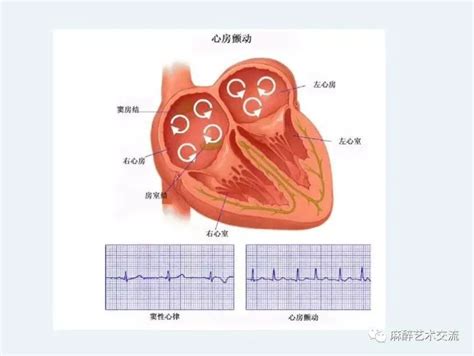 脉搏短绌图片,脉搏短绌绘制图片,脉搏短绌(第2页)_大山谷图库