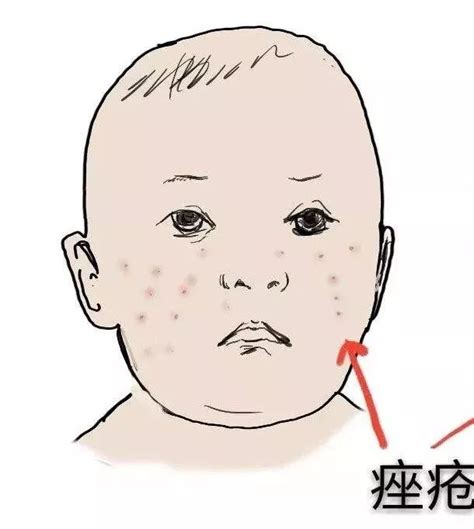 小孩各种皮肤病图片及症状（教你快速辨别9种宝宝常见皮肤病） | 说明书网