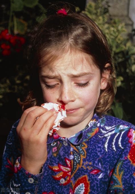 鼻出血怎么办快速解决（孩子为什么总是流鼻血？教家长几个快速止血的妙招） | 说明书网
