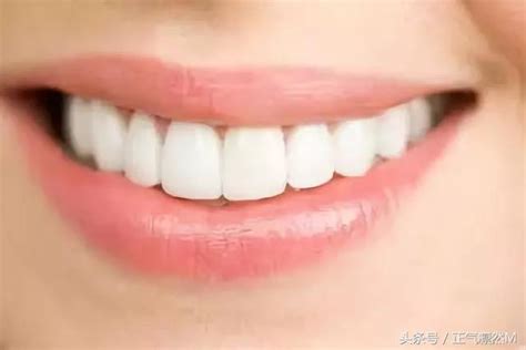 你的牙齿也有这些问题吗？ 需要及时矫正-海南口腔医院【官网】