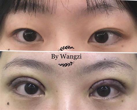 上海九院双眼皮修复专家是谁 - 整形医生预约网
