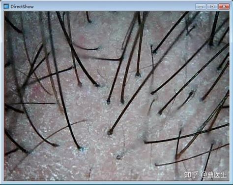 头发生长周期人类的皮肤毛囊解剖解剖海报头图片-包图网企业站
