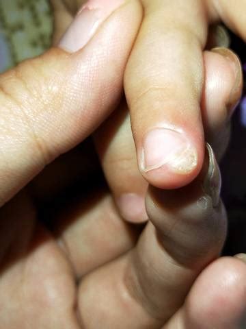 宝宝指甲上有白斑是什么原因 - 匠子生活