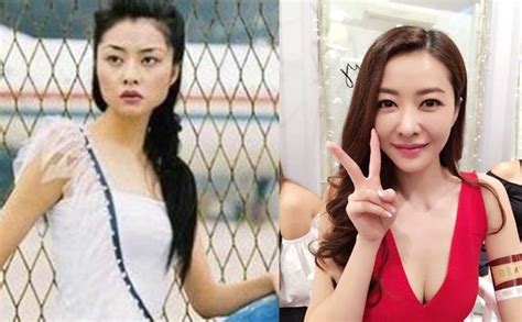 熊黛林图片整容前后照片