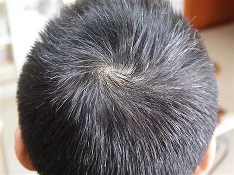 额头两边头发少适合什么发型男 男生额头两边头发少适合什么发型(3)_配图网