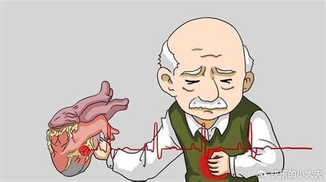 心律失常是急性心肌梗死的常见并发症，用什么药快速治疗心律失常？-12健康