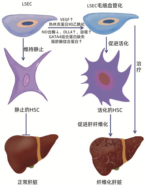 肝图片