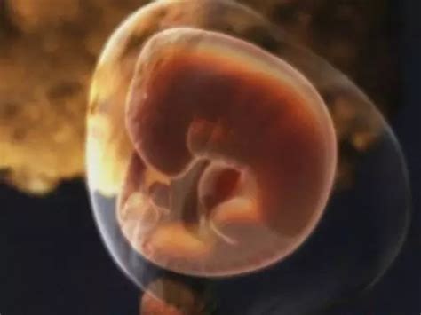 孕四个月胎儿的眼睛发育