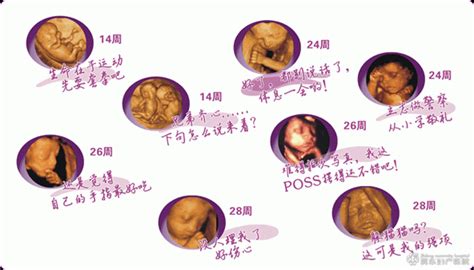 什么情况下需要做胎儿超声心动图