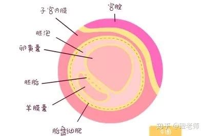 看不到孕囊但有卵黄囊