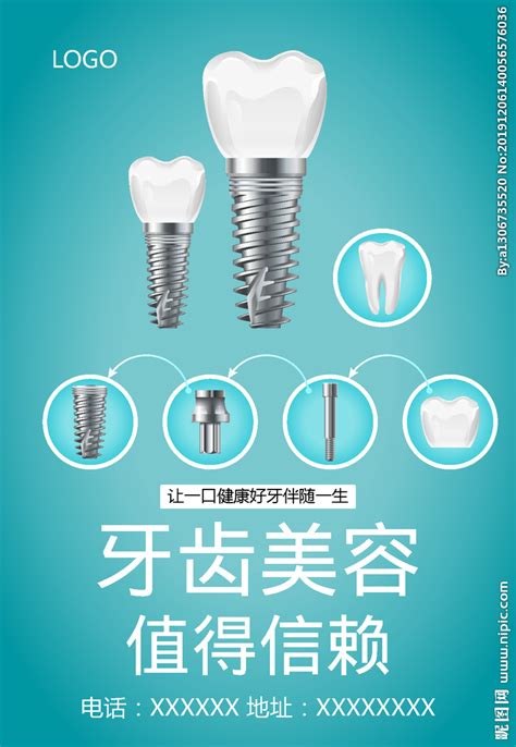 口腔种植牙广告北京