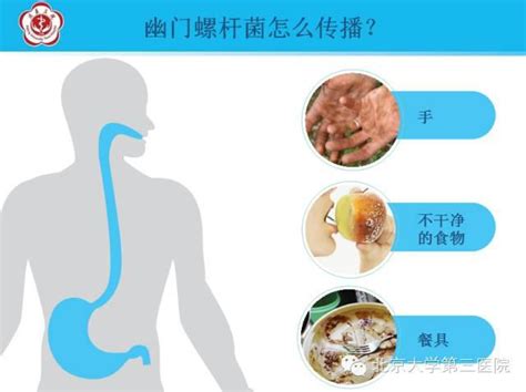 幽门杆菌口臭吃什么药