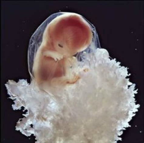 胎儿停止发育能治好吗